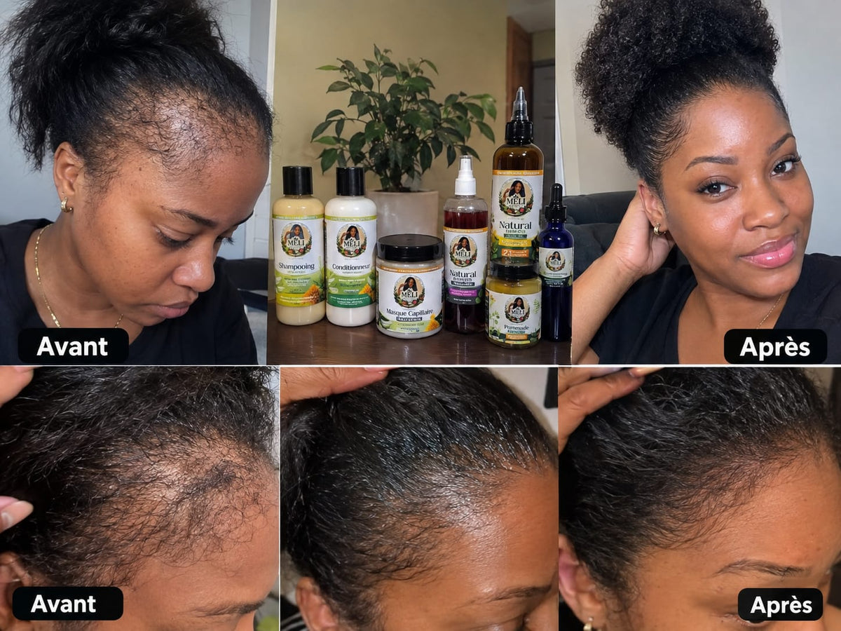 Meli Complete Hair Care Bundle – All 8 Natural Products